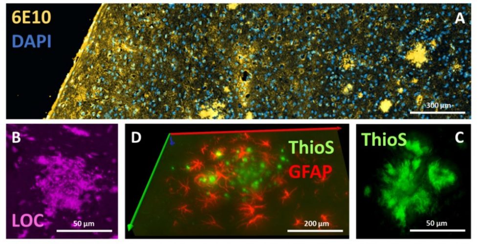 APP/PS1 Mouse Model for Alzheimer's Disease PsychoGenics